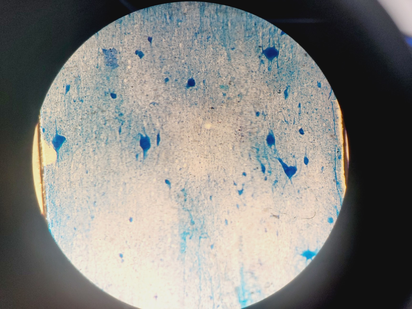 Image of  Carl Zeiss Axio Scope.A1 Microscope w/ AxioCam ICc 5, CoolLED & PC