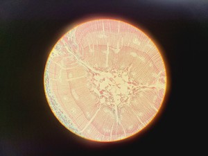 Thumbnail image of Leitz SM-LUX Binocular Microscope w/ 4 x Objectives 4/10/40/100x 