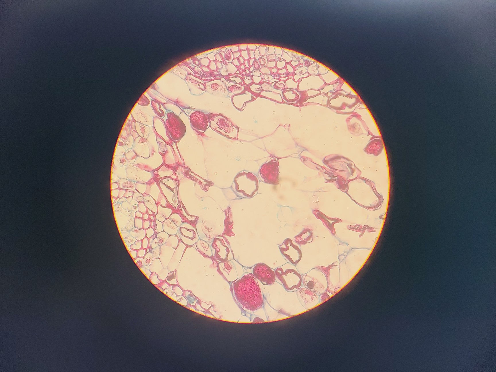 Image of Leitz SM-LUX Binocular Microscope w/ 4 x Objectives 4/10/40/100x 