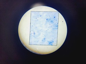 Thumbnail image of Amscope T120 Series Compound Microscope w/ 4 x Objectives 4/10/40/100 Oil 