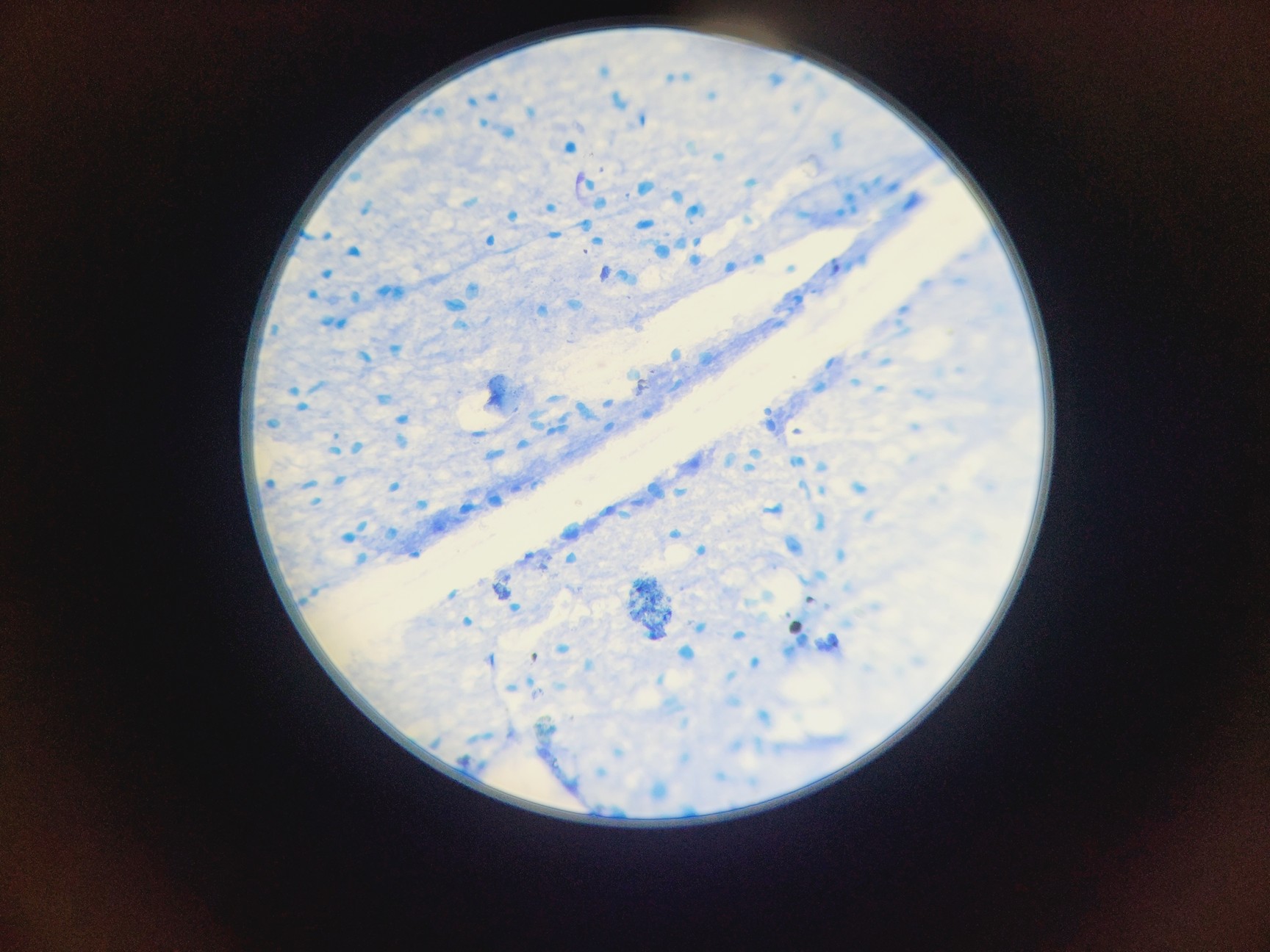 Image of Amscope T120 Series Compound Microscope w/ 4 x Objectives 4/10/40/100 Oil 